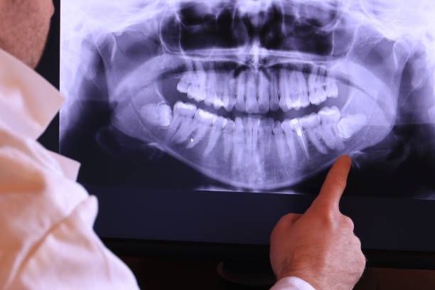 Best Same-Day Emergency Dentist in Teviston, CA