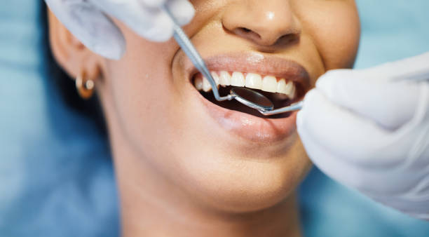 Best Emergency Broken Tooth Repair in Teviston, CA