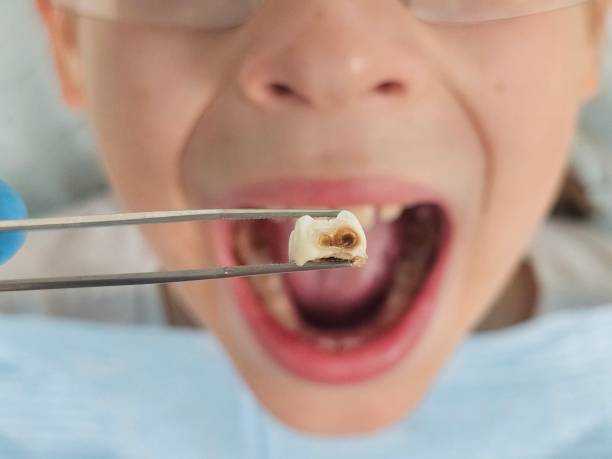 Best Emergency Orthodontic Repairs in Teviston, CA