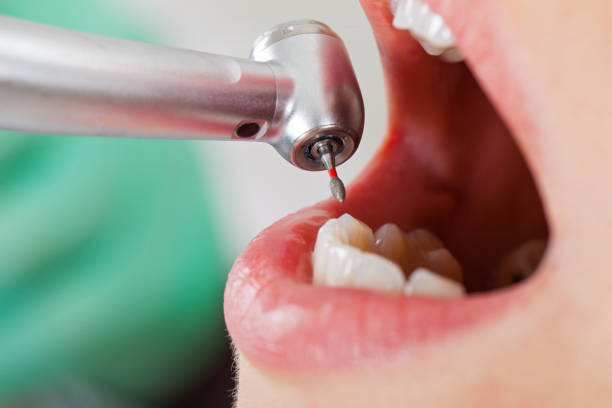 Best Walk-In Emergency Dentist in Teviston, CA